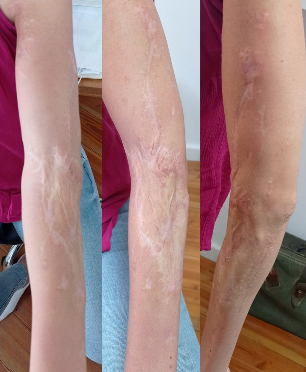 Agatka Kędra-Gdańsk-tatuaż-107579