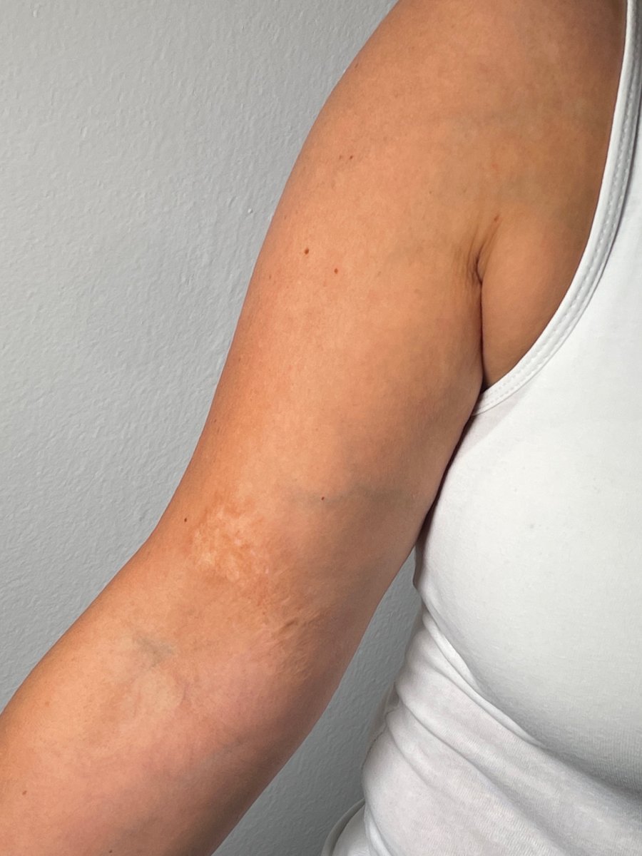 Marcin Martti Raczek -tatuaż-Realizm