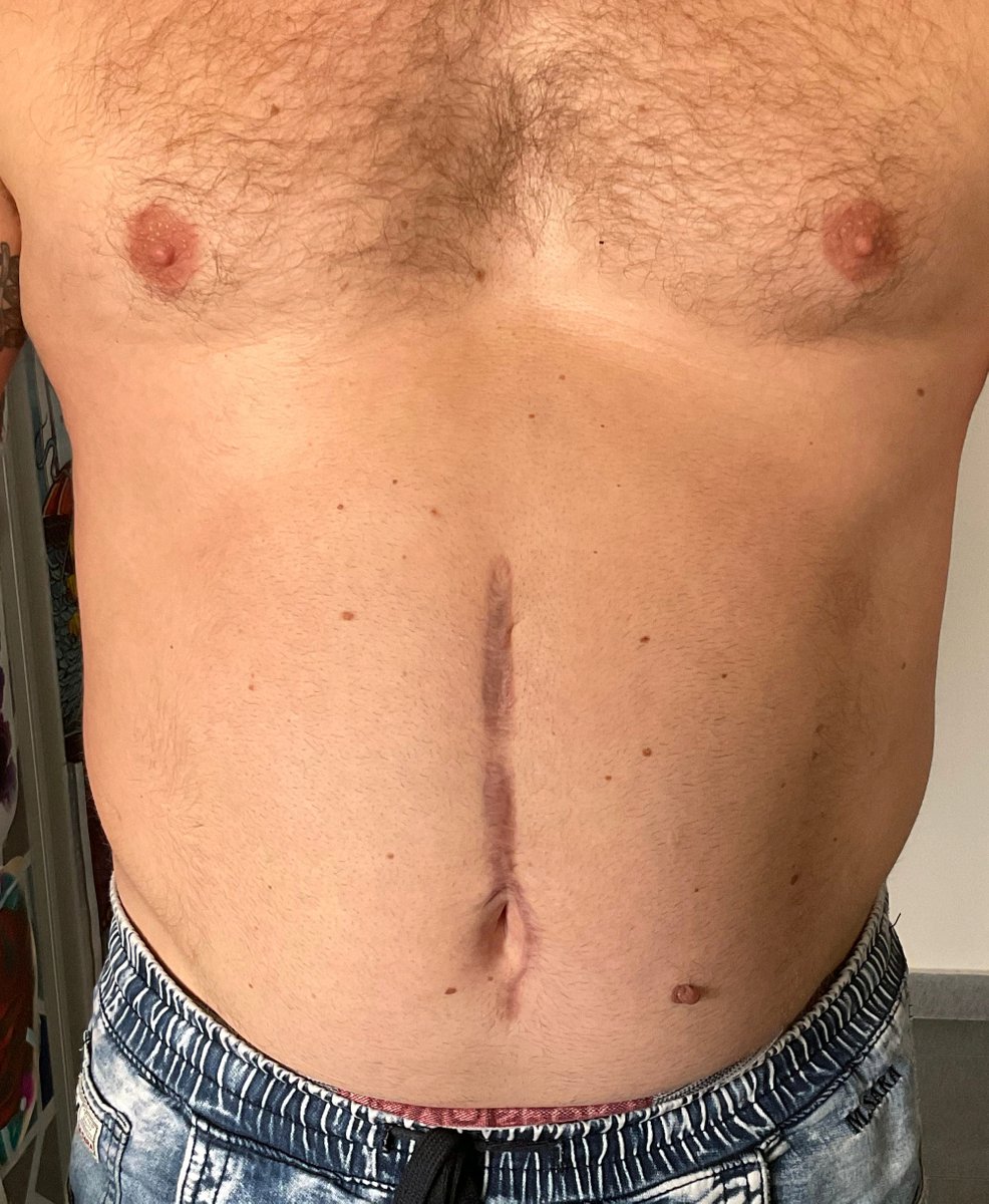 Jakub DINKZ Chruściel-tatuaż-Abstrakcyjny-Graficzny / Sketch-Newschool / Graffiti / Cartoon