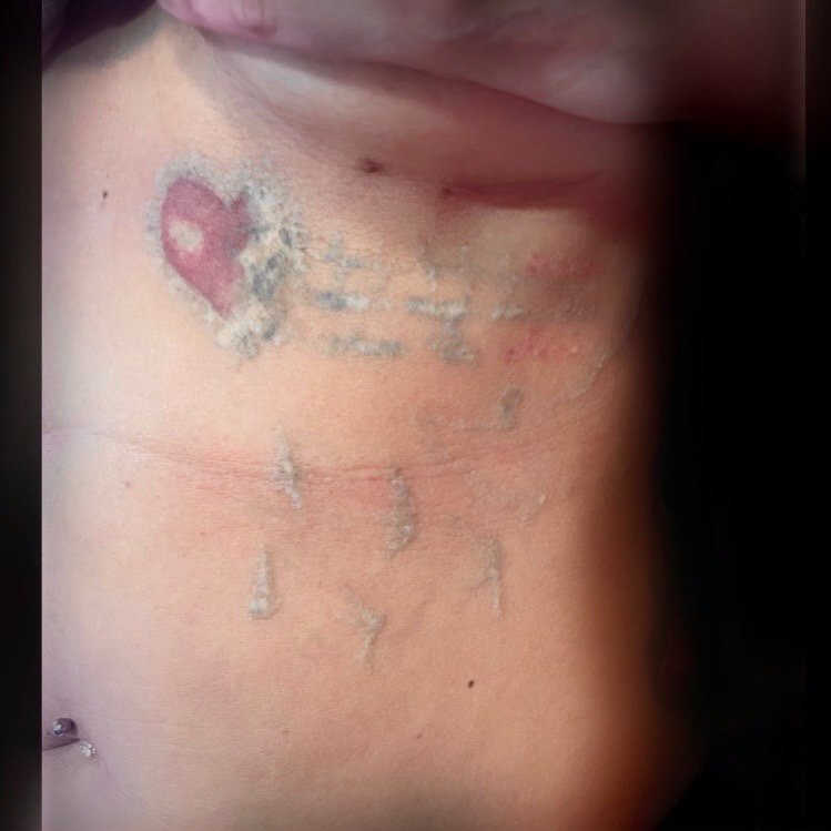 Izabela P.ink.Flaming-tatuaż-cover-blizny-Graficzny / Sketch-Line work / Fineline / Outline