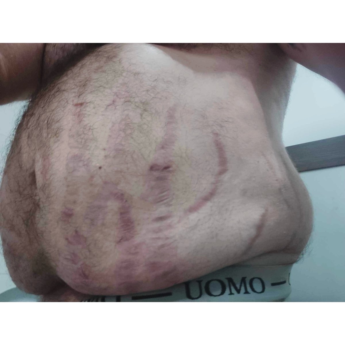 Ofelia Oferma-tatuaż-brzuch-Neo-tradycyjny-Newschool / Graffiti / Cartoon-Surrealizm / Horror